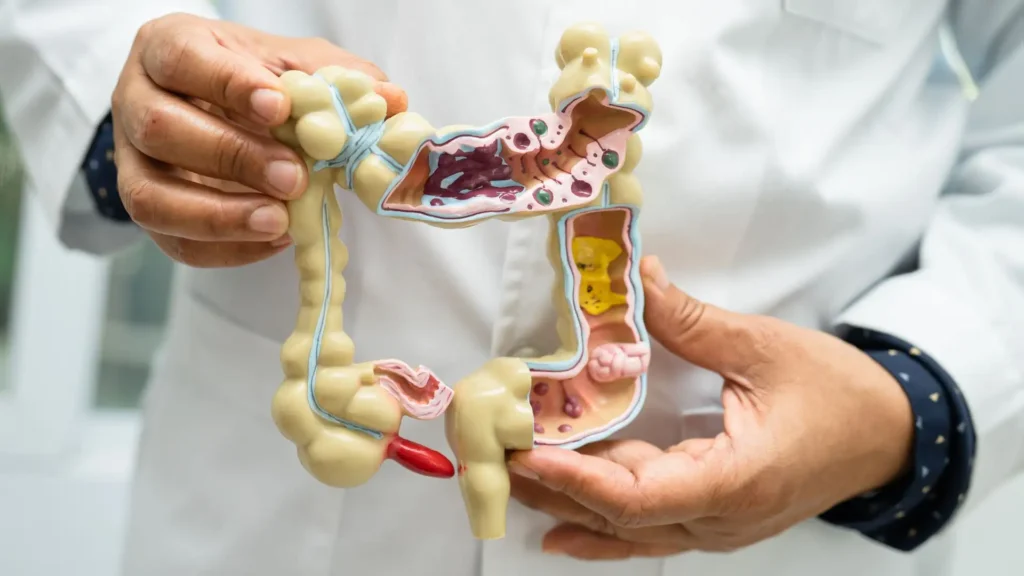 The Role of Gut Health in Brain Aging