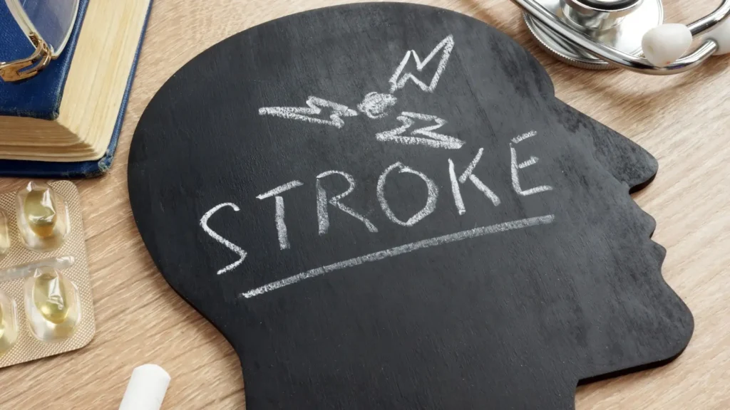 What You Should Know About Post-Stroke Dementia