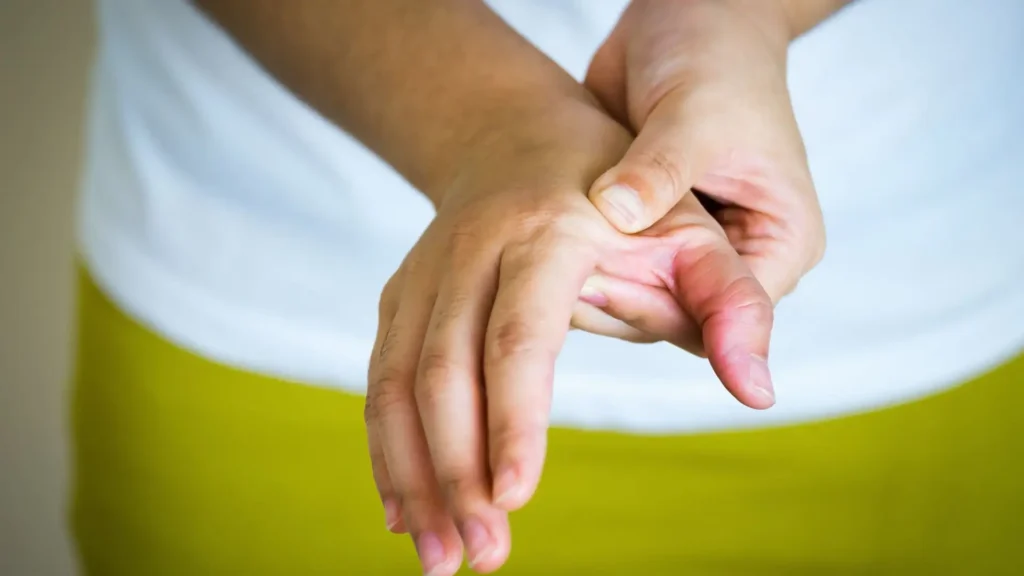 Reduce Swelling from Arthritis Flare