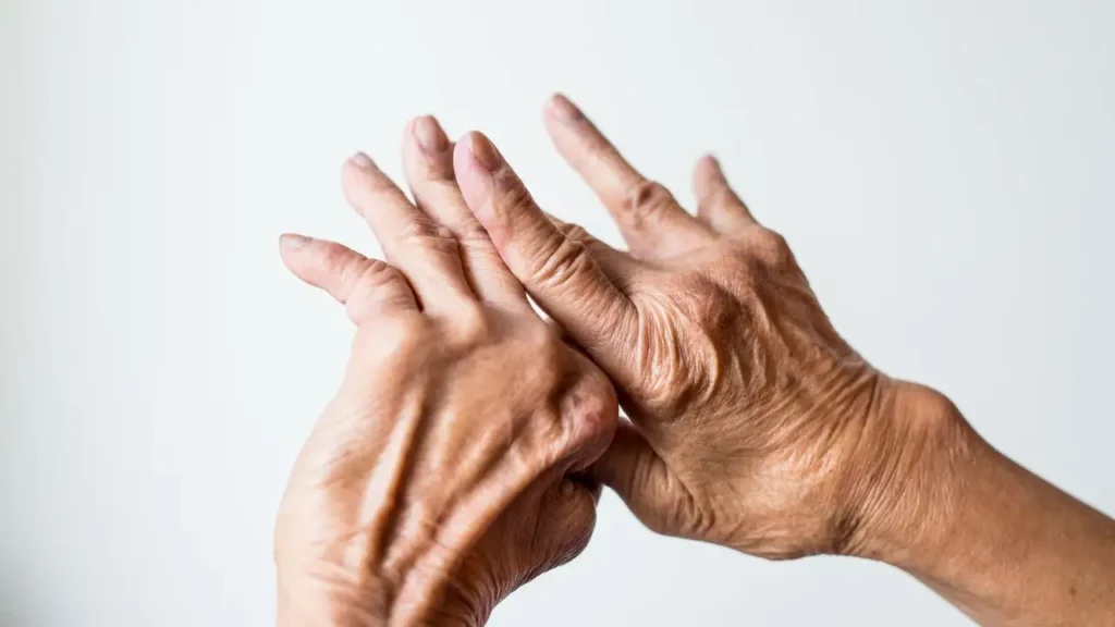 What Is Reactive Arthritis and Its Link to STIs