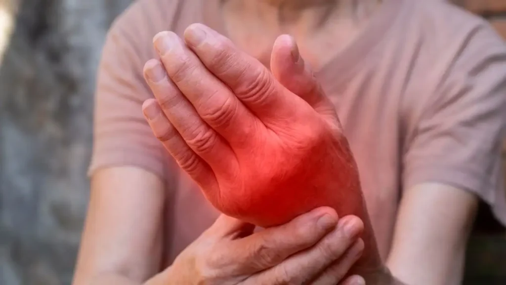 Signs and Symptoms of Arthritis Mutilans